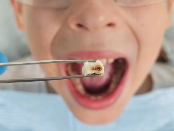 Best Emergency Broken Tooth Repair in East Vineland, NJ